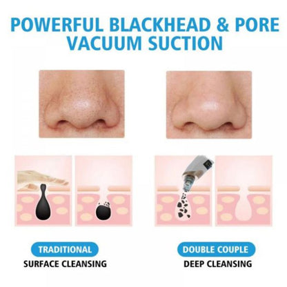 Electric Suction Blackhead Instrument Pore Cleaning (rechargable)